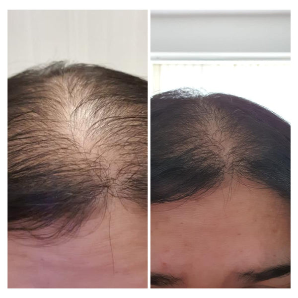 "I noticed thicker hair after the first use!"