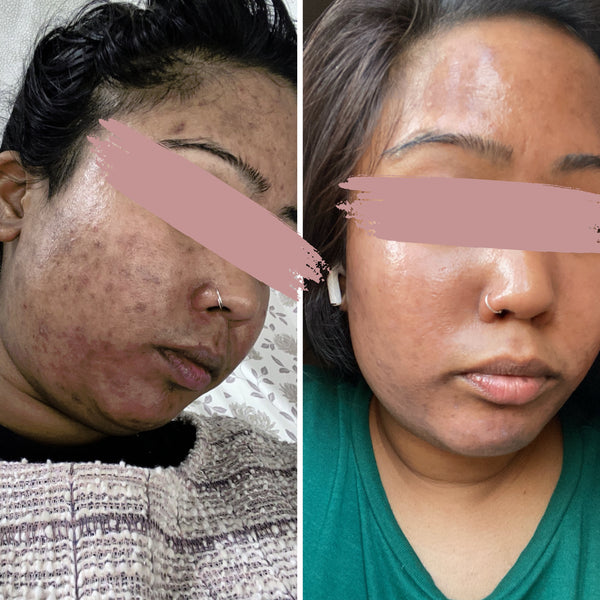 "I invested in good skincare, and it changed everything..."