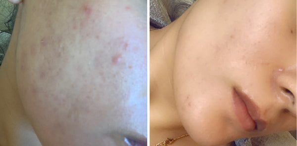 “My skin looked healthier, brighter, and tighter!"