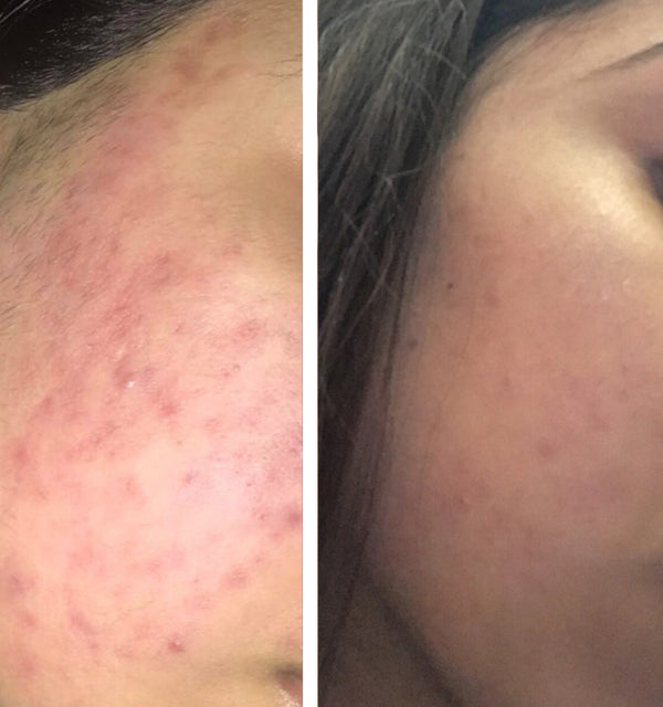 "Two months later and I could not be happier with the results!"