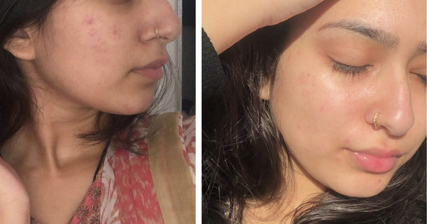 “I had no idea a serum could help so much!"