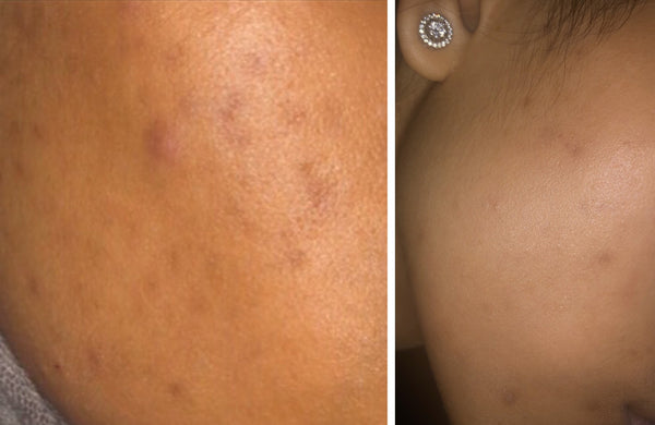 "I use the Brightening Serum every day before bed - I cannot live without it!”