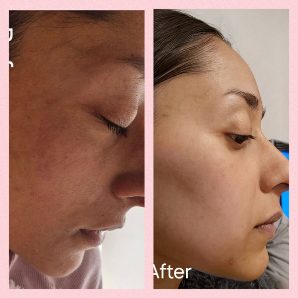 "I get a lot of compliments on my skin.. so it is very noticeable"