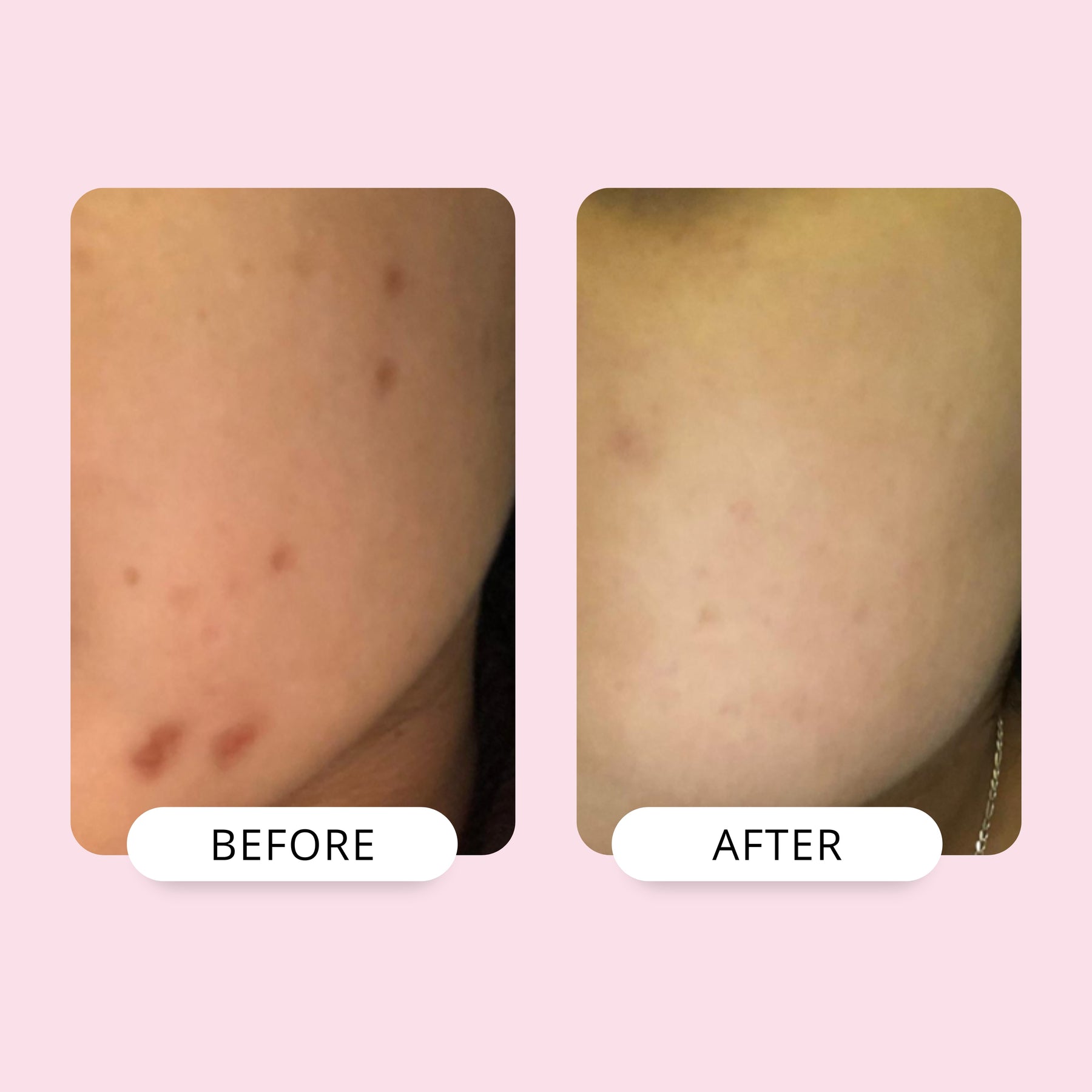 Bentonite OilEraser Clay Mask 50ml BaseLift