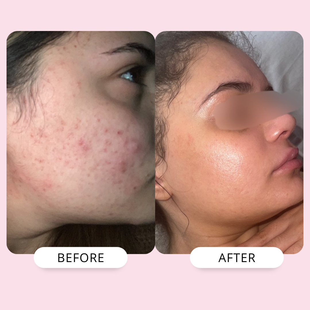 Rosehip & Marula Rehydration Oil | 30ml