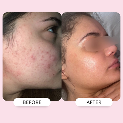 Rosehip & Marula Rehydration Oil | 30ml