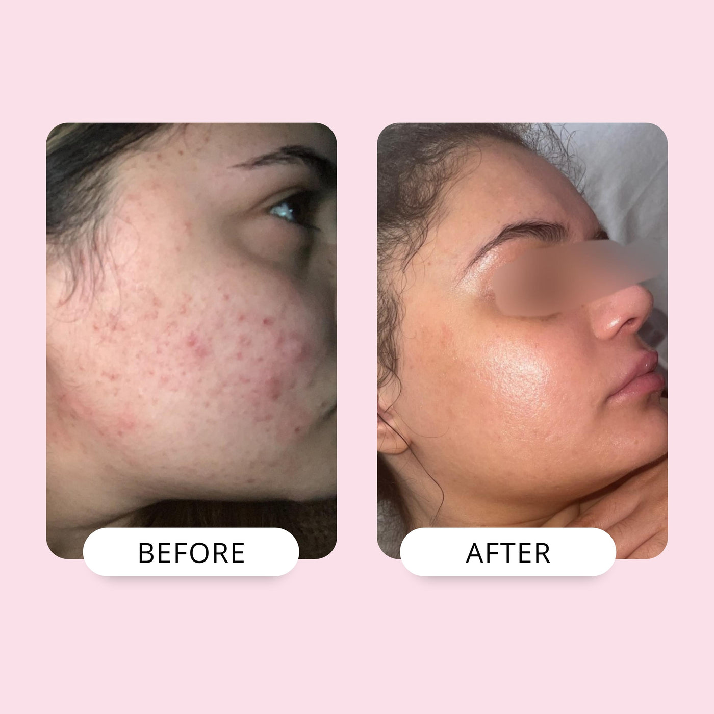 Duo Set - Rosehip & Marula Rehydration Oil | 30ml